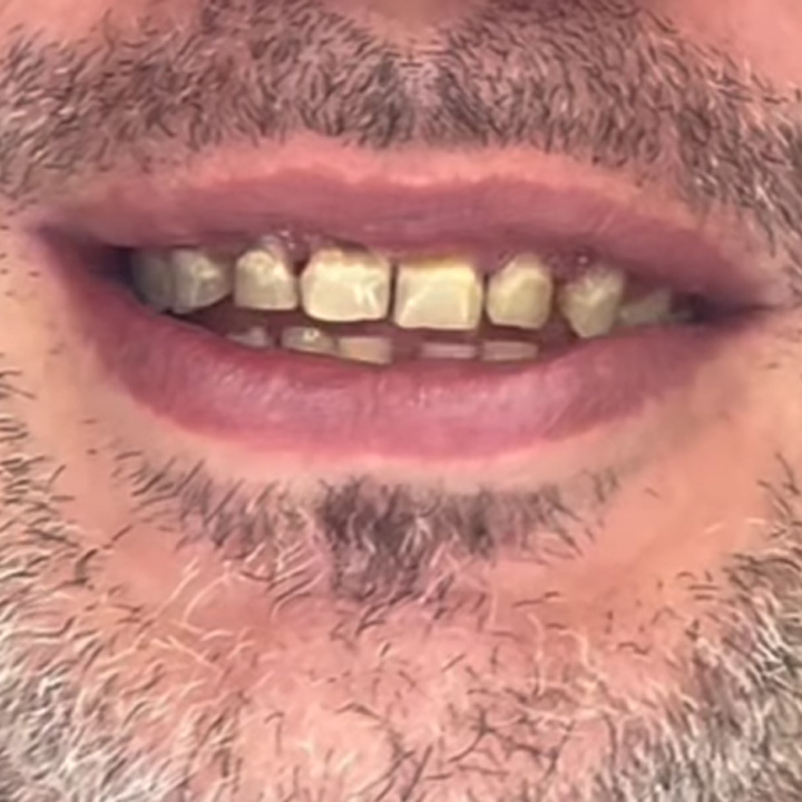 Dopo