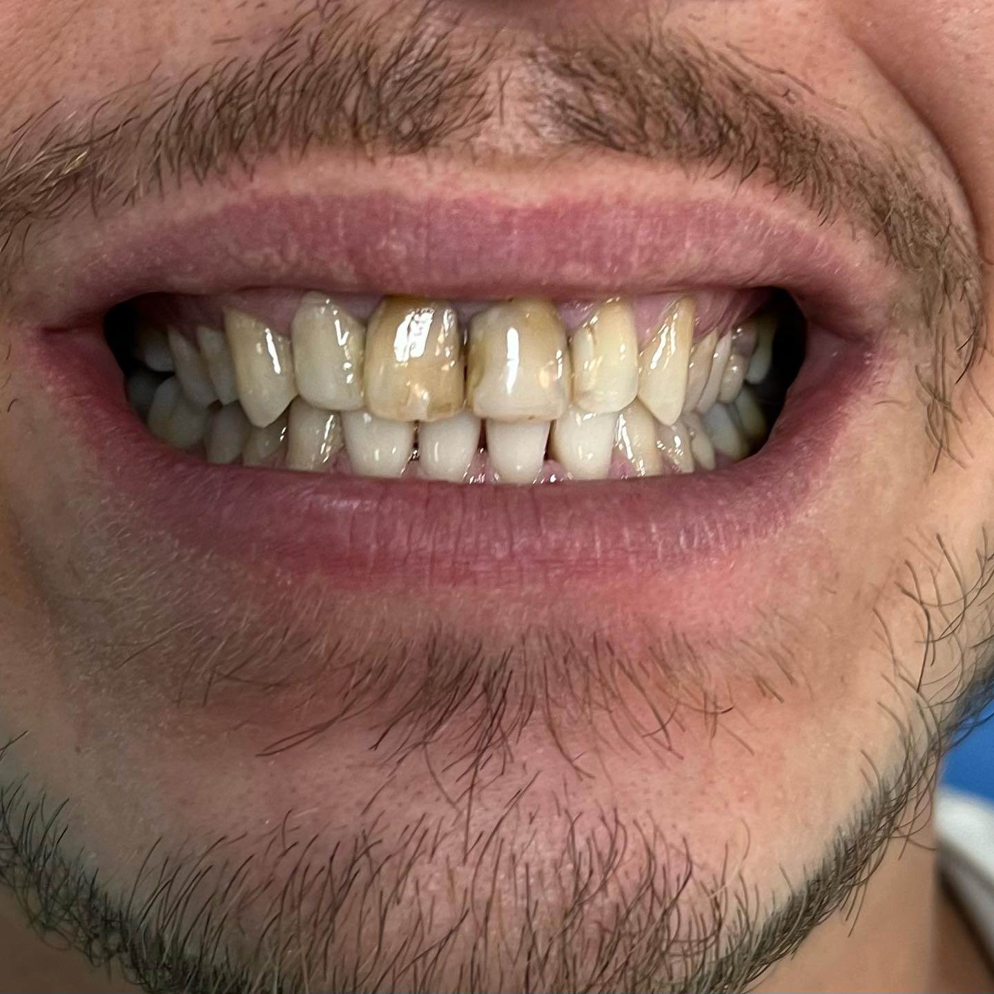 Dopo